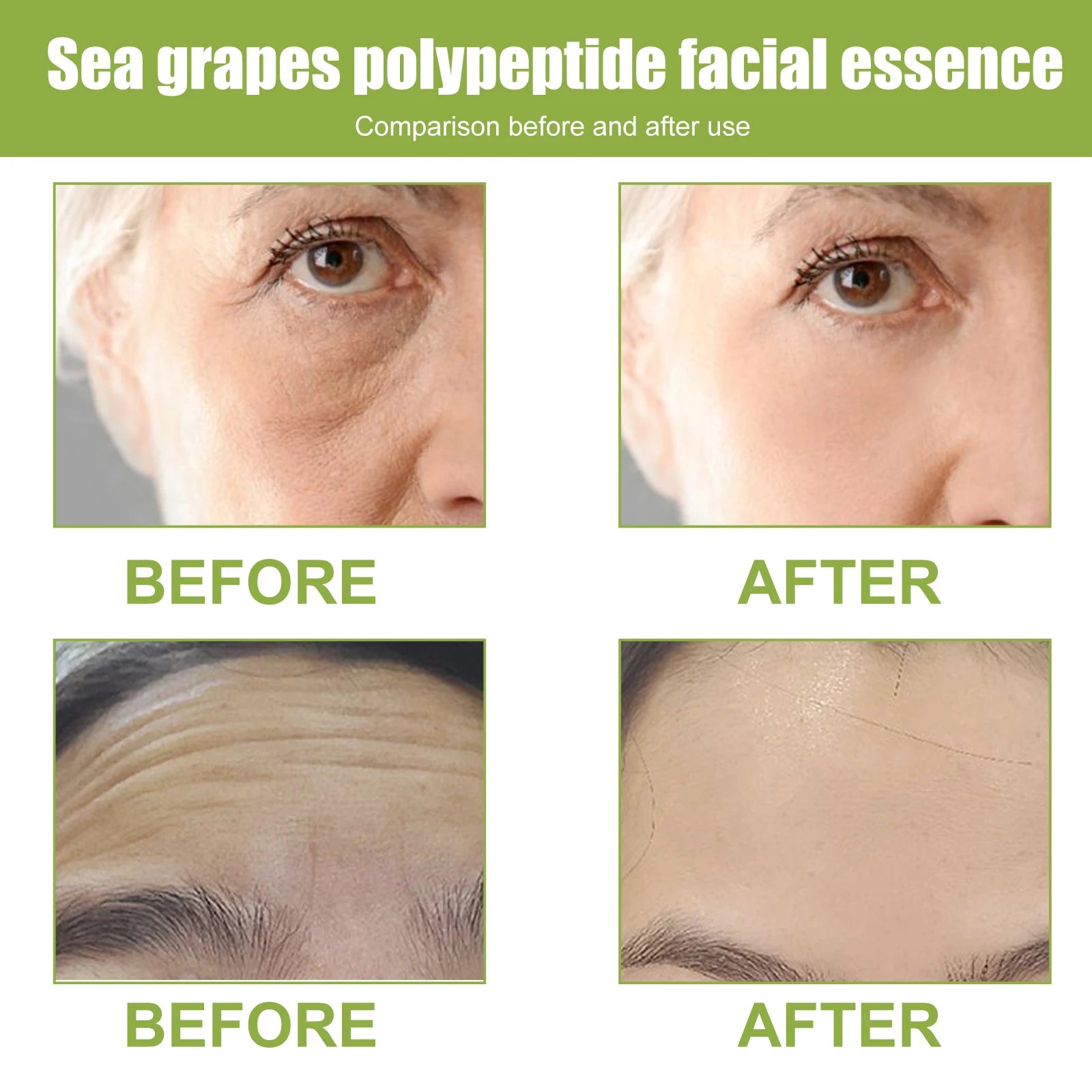 EELHOE Sea Grape Polypeptide Facial Essence Fade Fine Line Anti-wrinkle Firming Skin Lifting Moisturizing Booster Face Serum