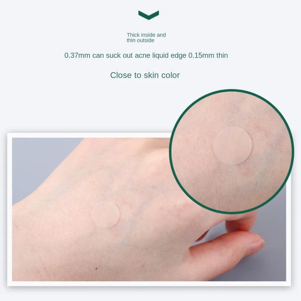 Skin Acne Removal Patch Invisible Beauty Stickers Pimple Patch Absorbing Liquid Transparent Acne Cleansing Patch Skin Care Tools