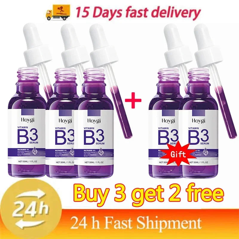 Hoygi Niacinamide Facial Serum Vitamin B3 Wrinkles Pigment Dark Spot Removal Correcting Glow Serum Face Whitening Moisturizer