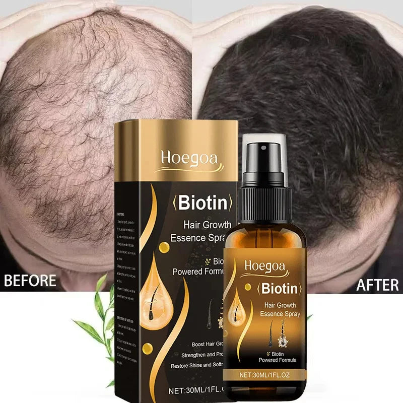 Biotin Fast Hair Growth Spray Anti Hair Loss Serum Prevent Baldness Treatment Scalp Beard Beauty Essence Hair Care Products 30ml
