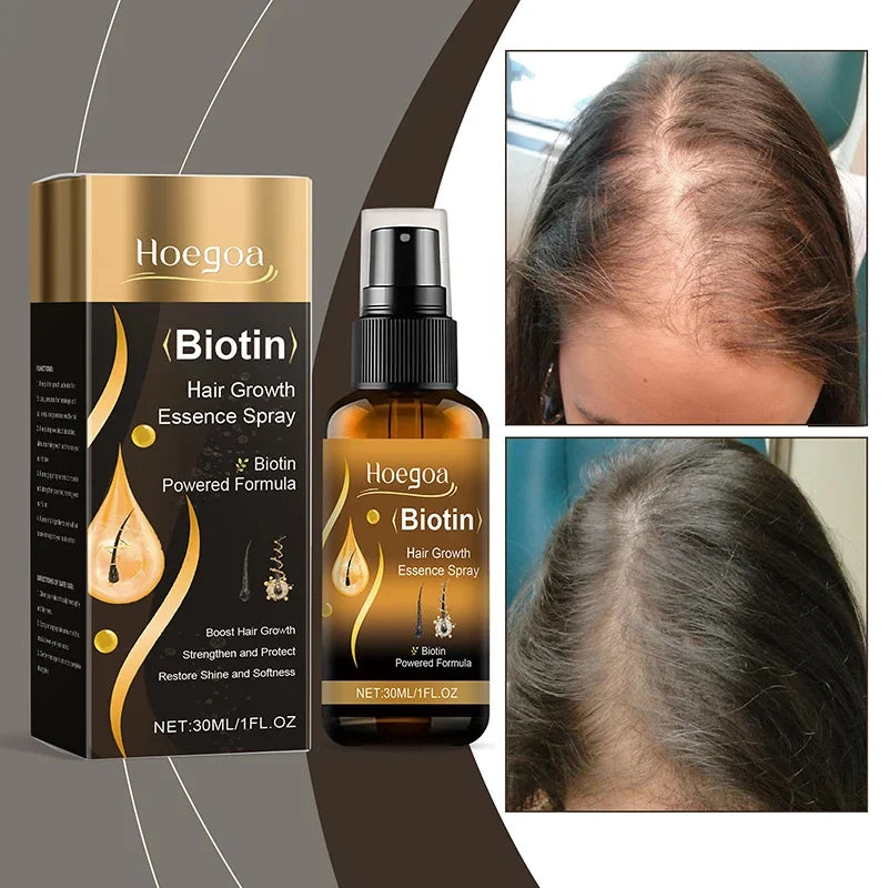 Biotin Fast Hair Growth Spray Anti Hair Loss Serum Prevent Baldness Treatment Scalp Beard Beauty Essence Hair Care Products 30ml